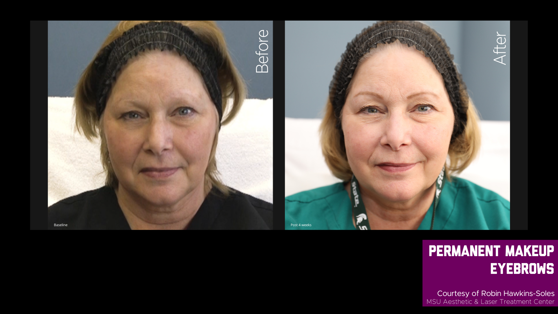 before and after treatment photos