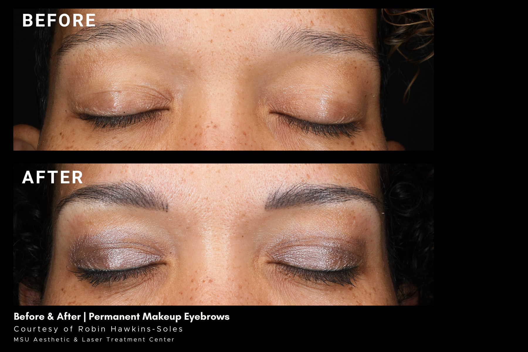 before and after treatment photos