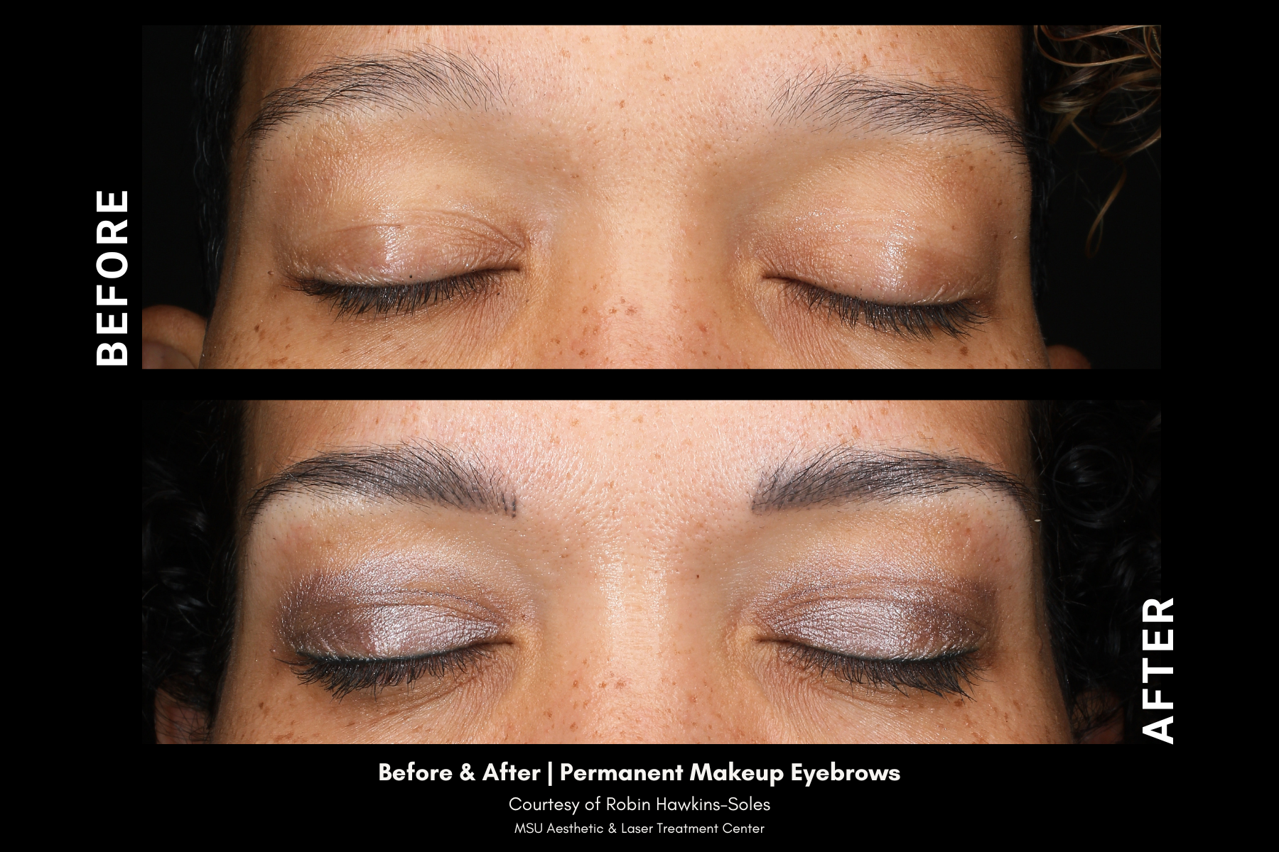 before and after photos of permanent cosmetic treatment